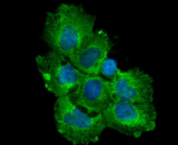 ICC staining TGF alpha in A431 cells (green)