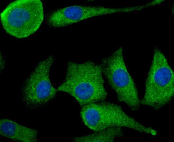 ICC staining TGF alpha in A549 cells (green)