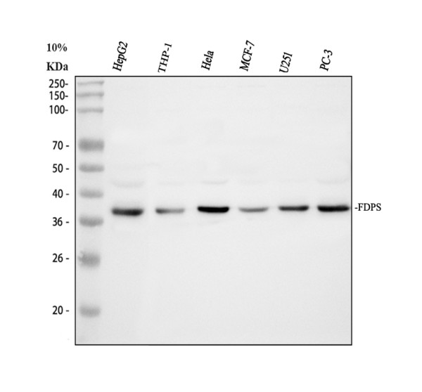 Western blot analysis of FDPS/FPS using anti-FDPS/FPS antibody (A01782-1)
