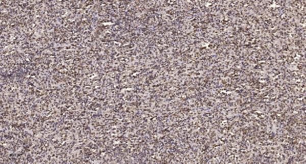 Immunohistochemical analysis of paraffin-embedded human spleen
