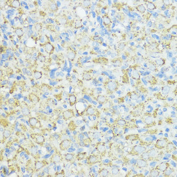 Immunohistochemistry of paraffin-embedded rat ovary using SOD3 antibody  at dilution of 1:100 
