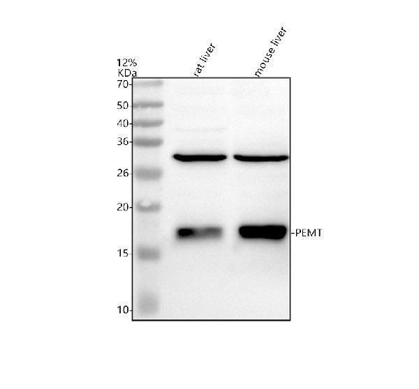 Western blot analysis of PEMT using anti-PEMT antibody (A01785-1)