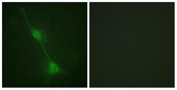a01786 1 atxn1 primary antibodies if testing 1