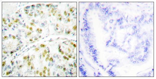 a01786 1 atxn1 primary antibodies ihc testing 3