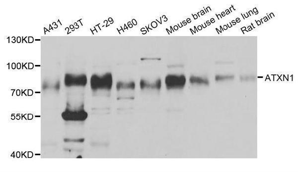 WesternBlot (WB) analysis of Ataxin-1 polyclonal antibody