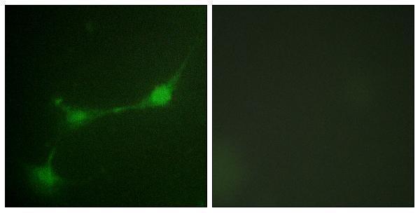 Immunofluorescence analysis of NIH/3T3 cells, using Ataxin 1 (Phospho-Ser776) Antibody