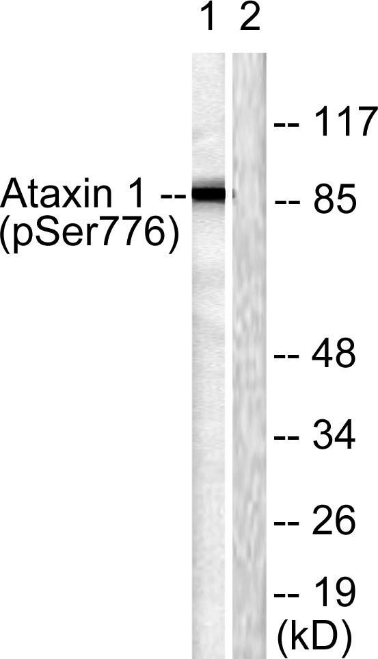 Western blot analysis of lysates from HepG2 cells treated with Adriamycin 0