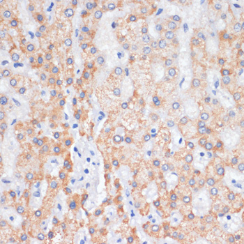 Immunohistochemistry of paraffin-embedded human liver using AREG antibody  at dilution of 1:100 