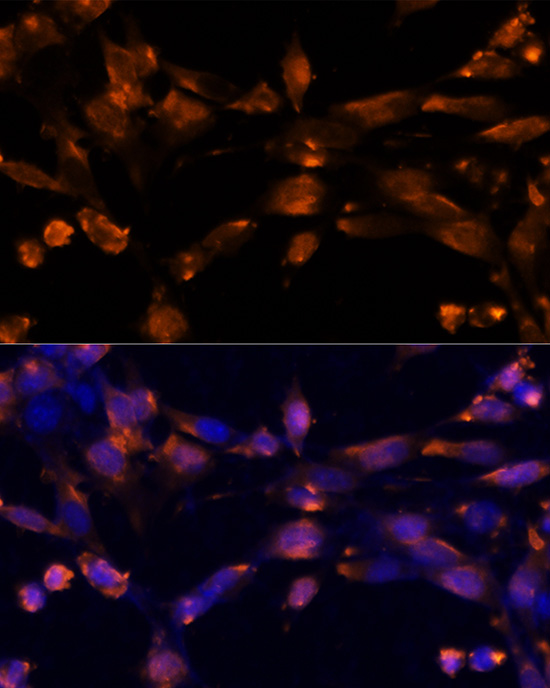 Immunohistochemistry of paraffin-embedded human tonsil using AREG antibody  at dilution of 1:100 