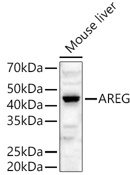 Western blot analysis of Mouse liver, using AREG antibody  at  1:480 dilution