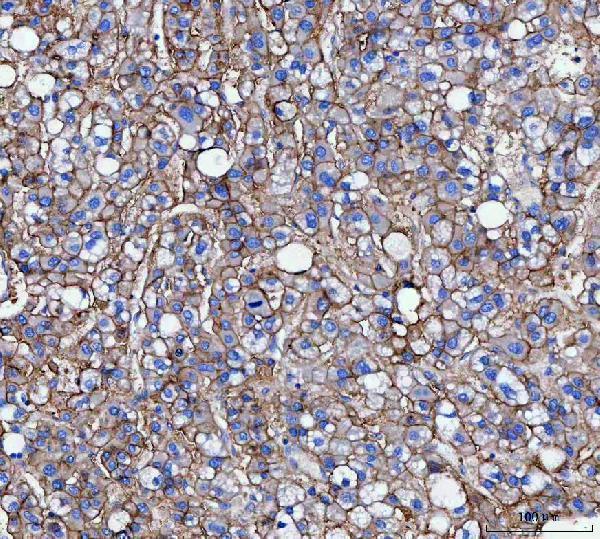 a01788 1 cd166 primary antibodies ihc testing 4_1
