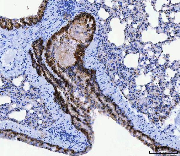 a01788 1 cd166 primary antibodies ihc testing 5_1