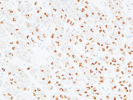 a01788 alcam primary antibodies ihc testing 1