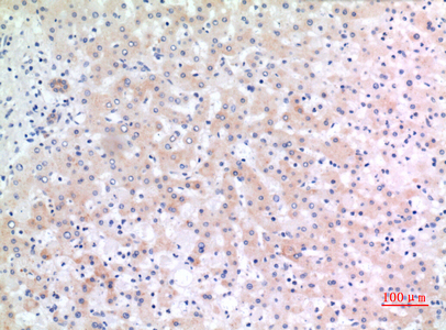 Immunohistochemical analysis of paraffin-embedded human-liver, antibody was diluted at 1:100