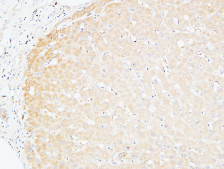 a01788 alcam primary antibodies ihc testing 5