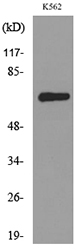 Western blot analysis of lysate from K562 cells, using ALCAM Antibody