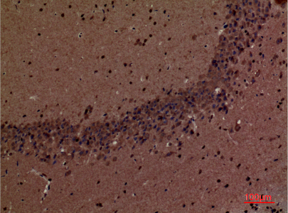 a01790 1 inppl1 primary antibodies ihc testing 1