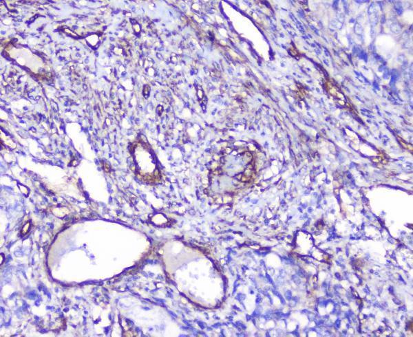 a01790 inppl1 primary antibodies ihc testing 2