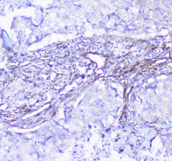 a01790 inppl1 primary antibodies ihc testing 3