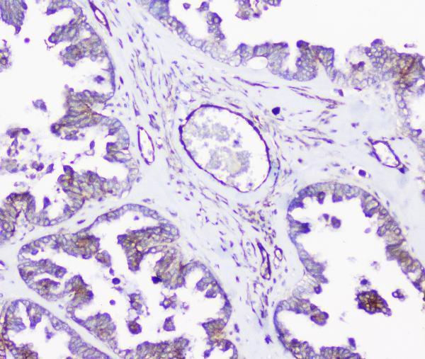 a01790 inppl1 primary antibodies ihc testing 4