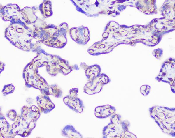 a01790 inppl1 primary antibodies ihc testing 5