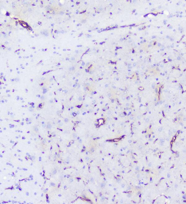 a01790 inppl1 primary antibodies ihc testing 7