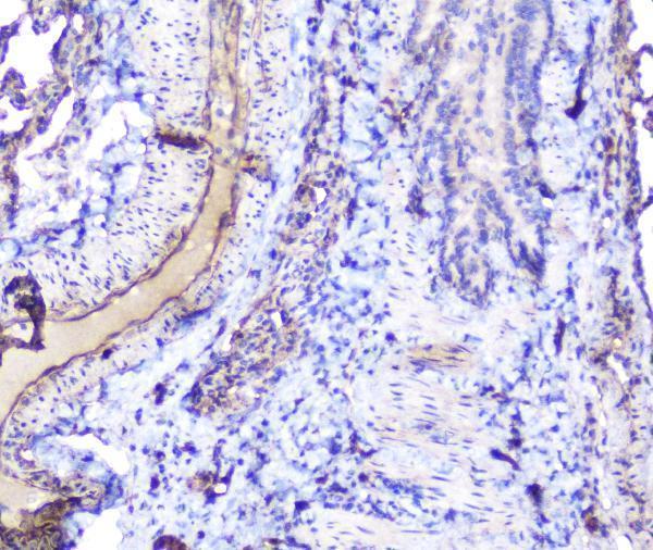 a01790 inppl1 primary antibodies ihc testing 8