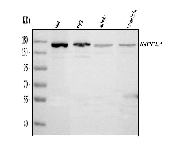 Western blot analysis of INPPL1 using anti-INPPL1 antibody (A01790).