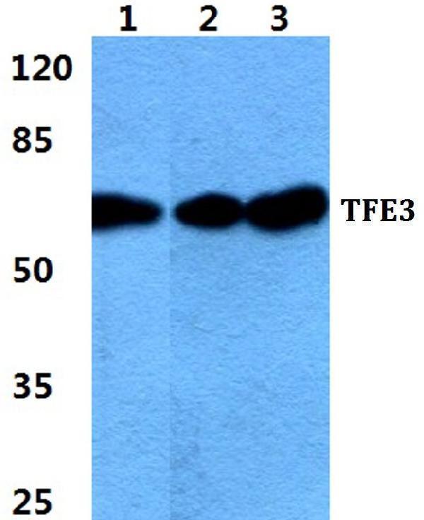 Western blot (WB) analysis of TFE3 polyclonal antibody at 1:500 dilution
Lane1:Hela cell lysate
Lane2:sp2/0 cell lysate
Lane3:PC12 cell lysate