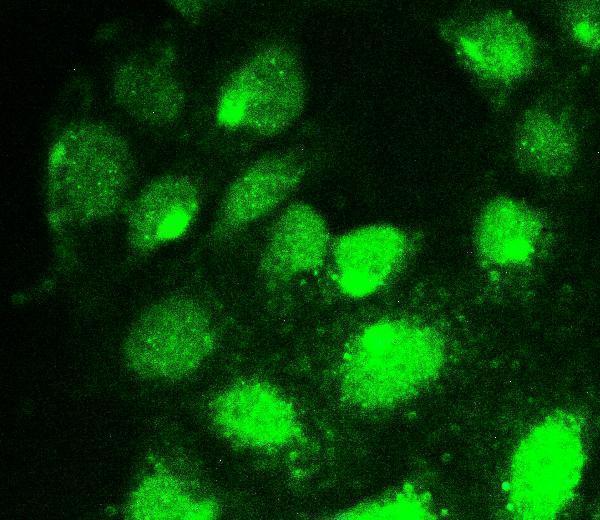 a01792 1 runx1t1 primary antibodies if testing 4