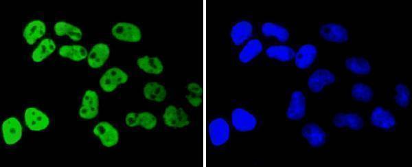 a01793 1 hnrnpk primary antiboties icc testing 2