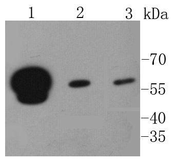 a01793 1 hnrnpk primary antiboties wb testing 1
