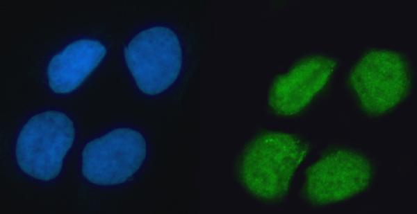  IF analysis of hnRNP K/HNRNPK using anti-hnRNP K/HNRNPK antibody (A01793-2)