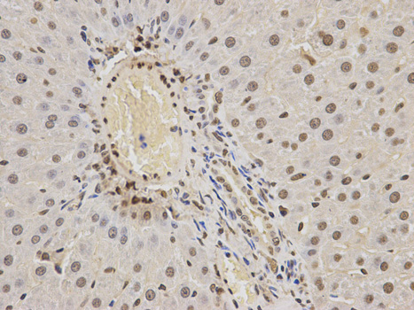 Immunohistochemistry of paraffin-embedded rat liver using hnRNP K Antibody  at dilution of 1:200 
