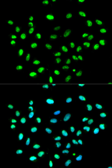 Immunohistochemistry of paraffin-embedded human esophagus using hnRNP K Antibody  at dilution of 1:200 