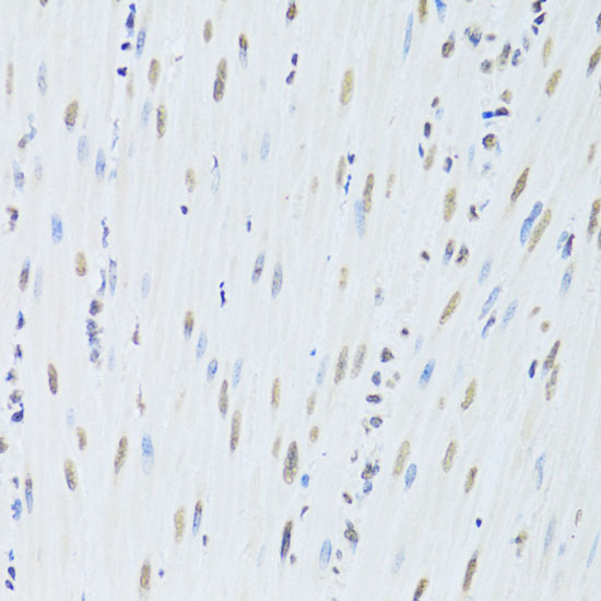 a01793 hnrnpk primary antiboties ihc testing 4