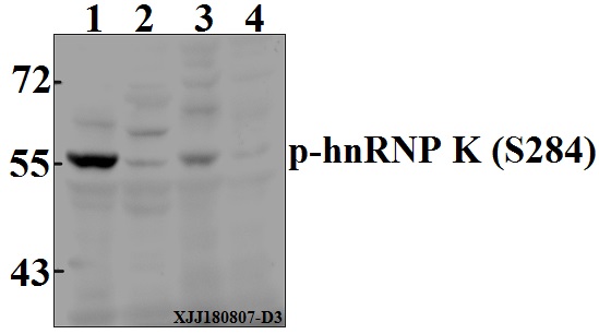 Western blot (WB) analysis of p-hnRNP K (S284) pAb at 1:500 dilution
Lane1:Hela whole cell lysate(40µg)
Lane2:HEPG2 whole cell lysate(40µg)
Lane3:CT-26 whole cell lysate(40µg)
Lane4:C6 whole cell lysate(40µg)