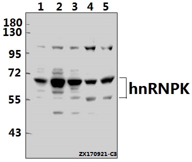 a01793y280 hnrnpk primary antiboties wb testing 1