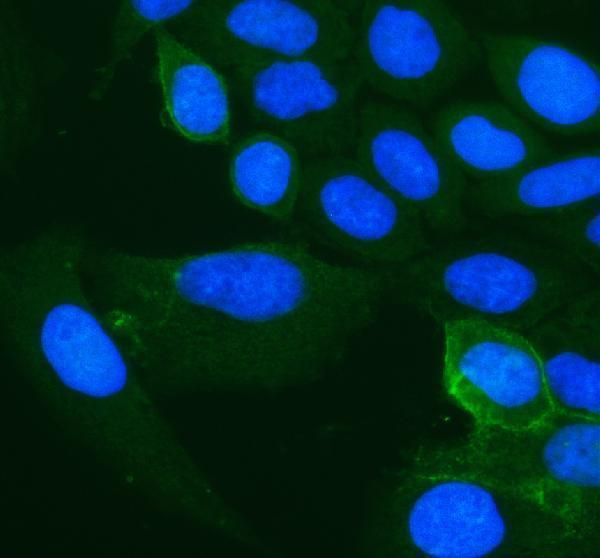a01794 4 cd98 slc3a2 primary antibodies if testing 1