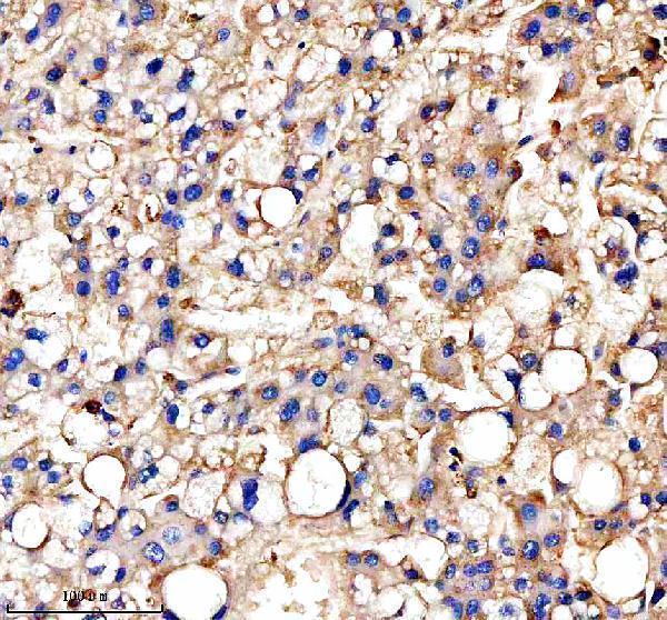 a01794 4 cd98 slc3a2 primary antibodies ihc testing 5
