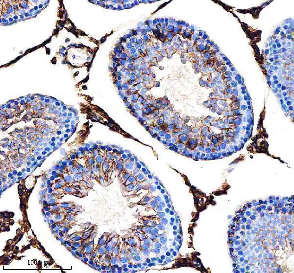  IHC analysis of CD98/SLC3A2 using anti-CD98/SLC3A2 antibody (A01794-4)
