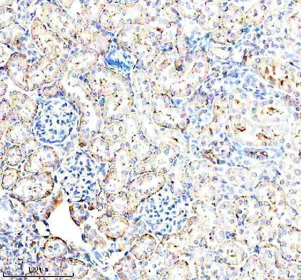  IHC analysis of CD98/SLC3A2 using anti-CD98/SLC3A2 antibody (A01794-4)