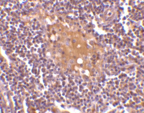 Immunohistochemistry of AIM in human lymph node tissue with AIM antibody at 10 μg/mL