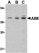 Western blot analysis of AIM in Raji lysate with AIM antibody at (A) 0