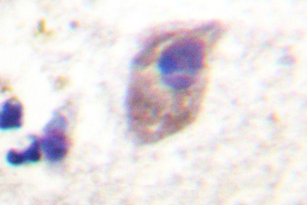 Immunohistochemistry (IHC) analyzes of p-PKC ζ (T560) pAb in paraffin-embedded human brain tissue