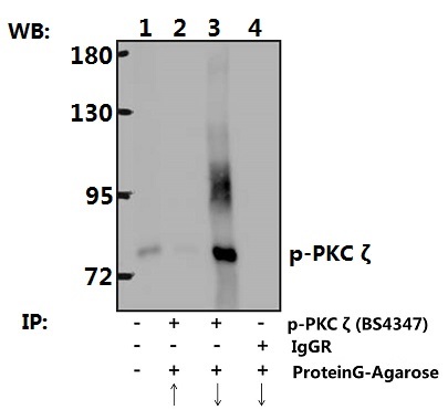 Immunoprecipitation of Brain tissue lysate of Rat using p-PKC ζ (T560)  polyclonal antibody (Sepharose Bead Conjugate) #BD0048(lane 2 and lane 3) 