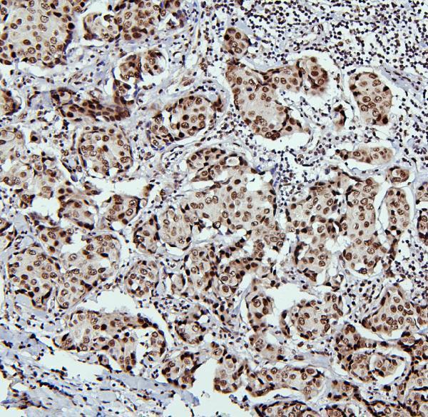 a01798 ptbp1 primary antibodies ihc testing 2