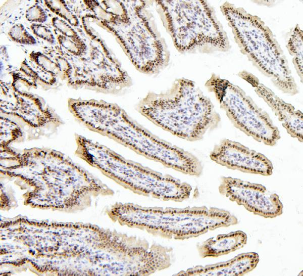 a01798 ptbp1 primary antibodies ihc testing 3