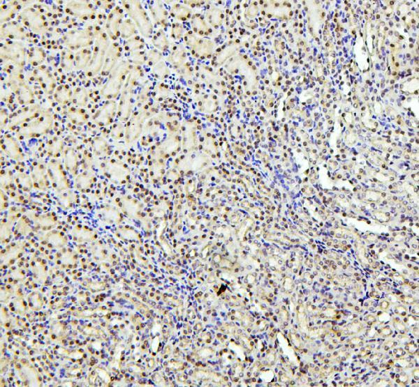 a01798 ptbp1 primary antibodies ihc testing 4