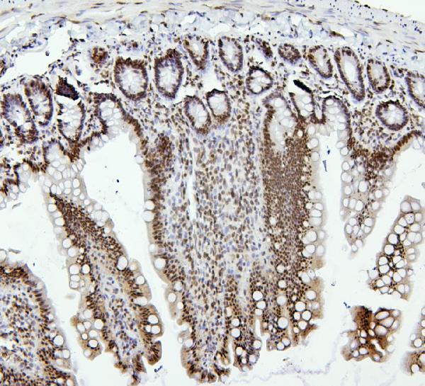 a01798 ptbp1 primary antibodies ihc testing 5